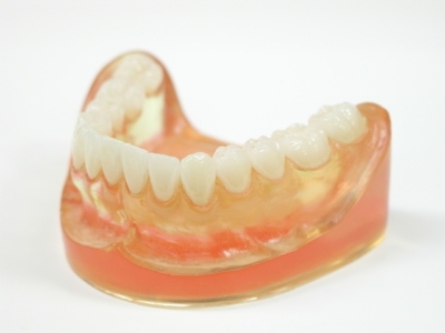 オールセラミック